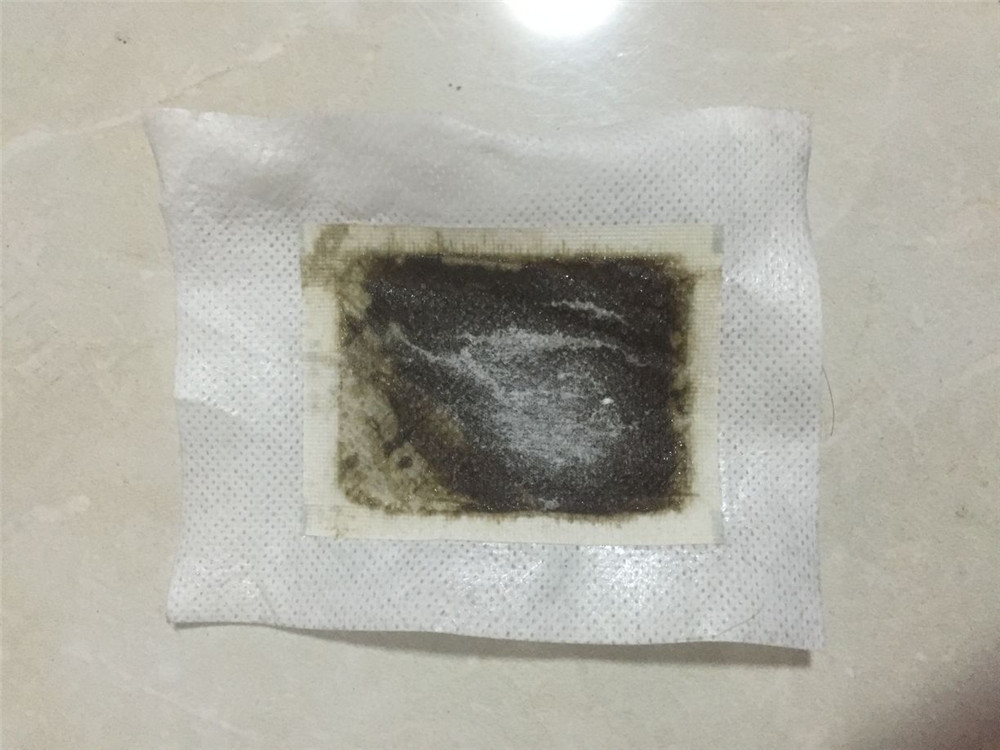 Medizinische, hochwertige Deto – Detox Foot Patch Bewertung und Preis