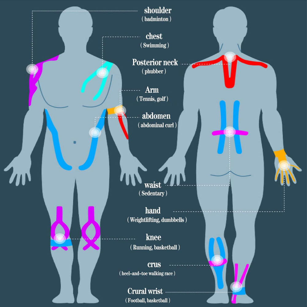 10 Stück Vorgeschnittene Kines – Sports Taping Precut Bewertung und Preis
